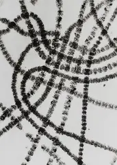 Wolf Strache, Spiral Algae (Spirogyra), 1952, Vintage ferrotyped gelatin silver print on Agfa-Portriga-Rapid paper