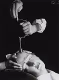 Herbert List, Trepanation, Wien