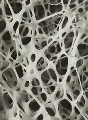 Carl Strüwe, Bauform der Knochenbälkchen des Menschen, 1940s/early 1950s, Vintage ferrotyped gelatin silver print on Agfa-Brovira paper
