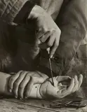 Peter Keetman, Hände, Prothesenwerkstatt