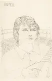 John Bellany, MY DAUGHTER ANYA, Etching, 3/75