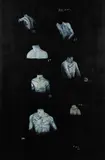 Tony de Lautour, Body Corp No. 2