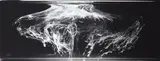 Joyce Campbell, Medusa, gelatin silver fibre-based handprint, 3/7 (2002)