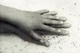 Peter Peryer, Thea's Hand