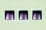 Merylyn Tweedie, Man the Cake, three selenium-toned Ilfobrom Galerie photographs mounted to board