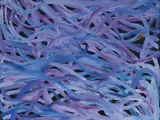 Evelyn Pultara, Bush Yam, Acrylic on Canvas
