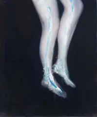 Alexander Tinei, "Healling Legs", 2011, Öl auf Leinwand
