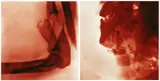 Via Lewandowsky, Kawumm (02) und Kawumm (03), 1997, Lambda-Print/Diasec