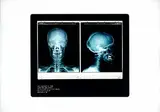 Damien Hirst British, Self Portrait