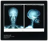 Damien Hirst British, Self Portrait
