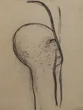 Werner Knaupp, Head with snakes, charcoal
