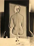 Josef Breitenbach, Electric Back, New York, 1949, Solarized gelatin silver print