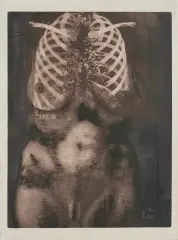Rafał Strent, Portret Pani Roentgen, 1977, akwaforta, akwatinta, papier