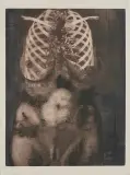 Rafał Strent, Portret Pani Roentgen, 1977, akwaforta, akwatinta, papier