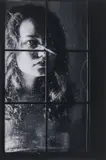 Helmut Morganti, Frontal lobotomy, photograph