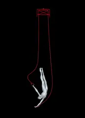Nickolaus Seffrin, Gymnast on Rings, c.2000, Painted Metal Sculpture