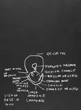 Jean-Michel Basquiat, View of Base of Skull, 1982, Lithograph