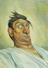 Albert Birkle, Der Akrobat Schulz V, 1921, Tempera