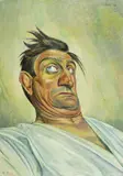 Albert Birkle, Der Akrobat Schulz V, 1921, Tempera