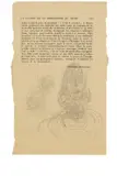 Alberto Giacometti, Buste de femme