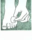 Roy Lichtenstein, Foot Medication Poster, 1963, Offset lithograph