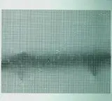 Heinz Mack, Chromrelief, 1971, Multiple