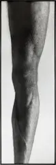 Balthasar Burkhard, Das Knie, 1983, Photography on baryta paper in original iron frame and on colour canvas