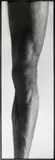 Balthasar Burkhard, Das Knie