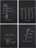 Jean-Michel Basquiat, Anterior View; Right Humerus; Female Pelvis; and Posterior View, from Anatomy, 1982, Four screenprints in black, on Arches paper, the full sheets
