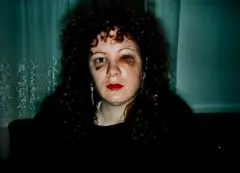 Nan after being battered by Nan Goldin, 1984, Dye destruction print, sold Apr 2023