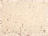 Howardena Pindell, Untitled, 1976, Lithograph in colors, with handmade paper Chine collé to Arches paper, the full sheet