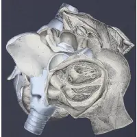 Frederick Sommer, Untitled, Collage of reprographic prints