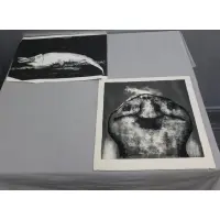 Aubrey Schwartz, Untitled, Lithographs