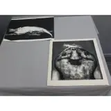 Aubrey Schwartz, Untitled, Lithographs