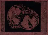 Horst Janssen, 3 Bll. Dosen, Etching