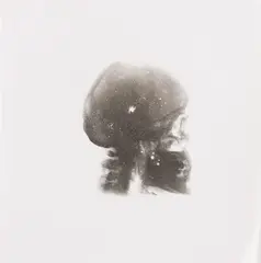Rudolf Sikora, Autoportrét (Vesmír), Okolo 1980-1985, Fotografia, röntgenový snímok