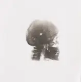 Rudolf Sikora, Autoportrét (Vesmír), Okolo 1980-1985, Fotografia, röntgenový snímok