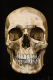 The Skull Beneath the Skin by Damien Hirst, Silketrykk med diamantstøv, sold Jun 2021