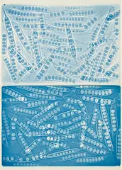 Sheila Pinkel, Peas (positive/negative), 1978-1982, Two Xeroradiographs