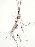 Alex Janvier, To Touch the Sick