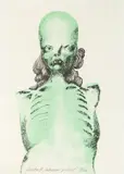 Jan Lebensztejn, Radographie portrait II, 1973, 1973, litografia, papier