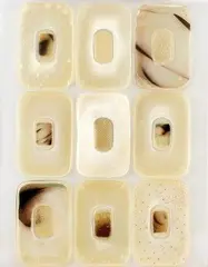 Gabika Binderová, Zimomriavky, 2001, fotoxeroxy na fóliách, pigmenty, silon, zalievané dentakrylom
