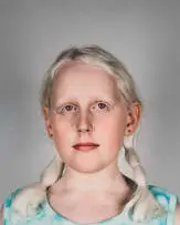 Pieter Hugo, Danielle Lawrence, United Kingdom, 2003, Portraits of Albinos Series, 2003, archival pigment ink on cotton paper laid down on card