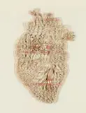 Lyndi Sales, Heart