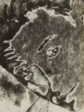 Maurice Tabard, Untitled (solarized face), circa 1930, Gelatin silver print