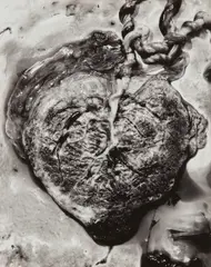 Frederick Sommer, Placenta, 1940, Gelatin silver print, mounted
