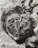 Frederick Sommer, Placenta