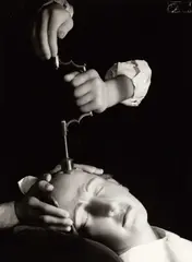 Herbert List, Trepanation (skull surgery)', from 'Präuscher's Panoptikum', Vienna 1944, 1944, Gelatin silver print, printed c. 1990 on double-weight paper