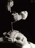 Herbert List, Trepanation (skull surgery)', from 'Präuscher's Panoptikum', Vienna 1944, 1944, Gelatin silver print, printed c. 1990 on double-weight paper