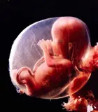 Lennart Nilsson, 11-weeks-old fetus, Karolinska Institute, Stockholm, August 1971, 1971, Chromogenic print on glossy paper, in good condition. Enclosed is a proof offset print of an advertisement for the Continental Group (manufacturer of all types of packaging) using the motif with the s